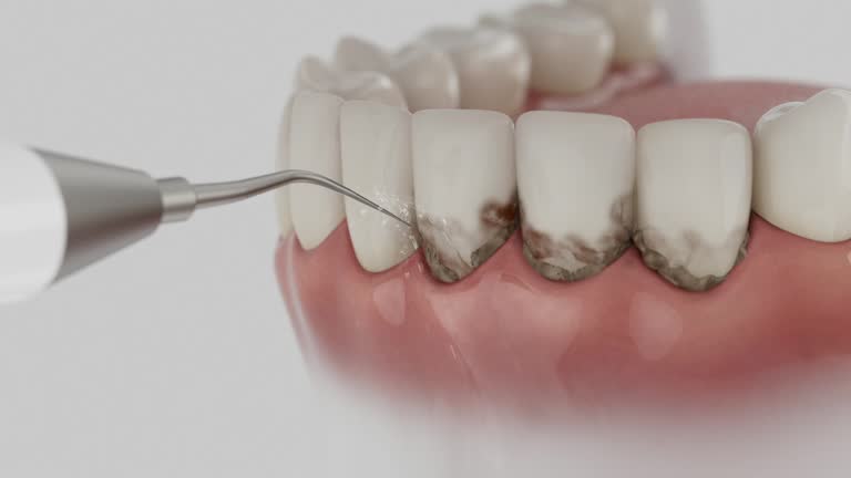 Reliable Dental Crowns And Bridges contractor in Decatur County County, IA by Dentist Open Now